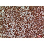 Immunohistochemistry - Anti-CCR3 Antibody (C30578) - Antibodies.com