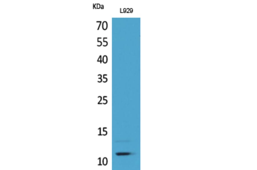 Western Blot - Anti-CCL8 Antibody (C30592) - Antibodies.com