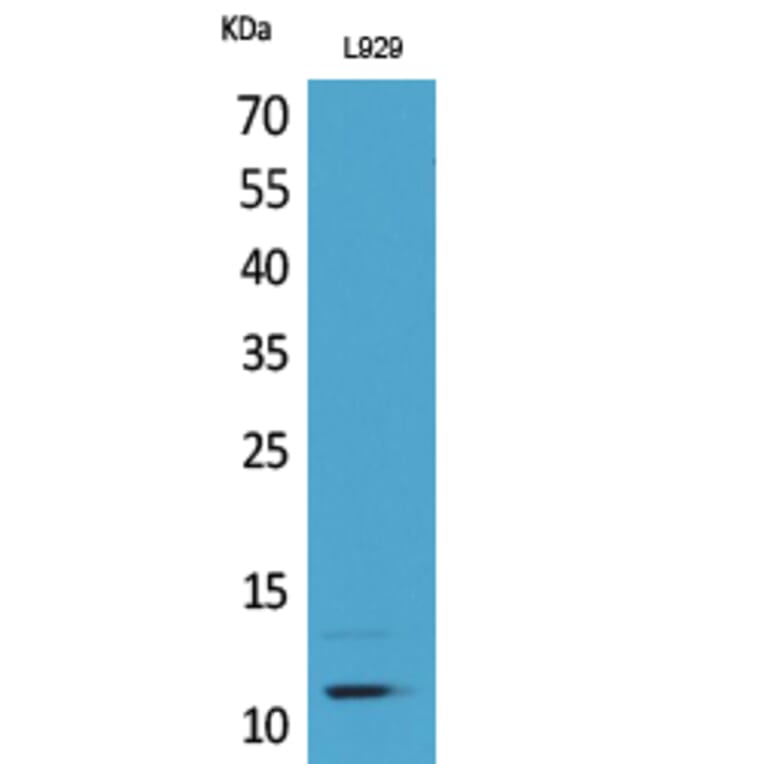 Western Blot - Anti-CCL8 Antibody (C30592) - Antibodies.com