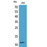 Western Blot - Anti-CCL8 Antibody (C30592) - Antibodies.com