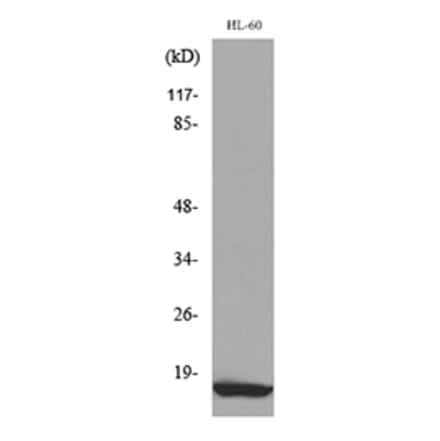 Western Blot - Anti-CCL4 Antibody (C30171) - Antibodies.com