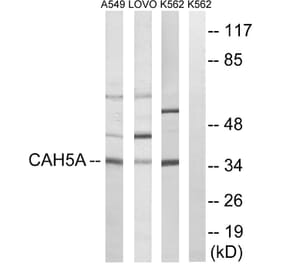 Western Blot - Anti-CA5A Antibody (C14941) - Antibodies.com