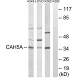 Western Blot - Anti-CA5A Antibody (C14941) - Antibodies.com