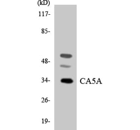 Western Blot - Anti-CA5A Antibody (R12-2557) - Antibodies.com