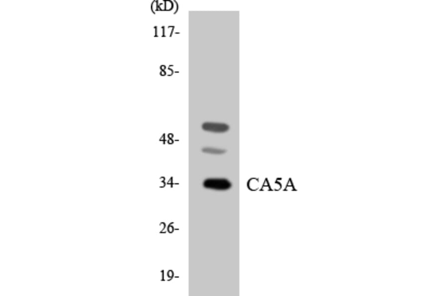 Western Blot - Anti-CA5A Antibody (R12-2557) - Antibodies.com