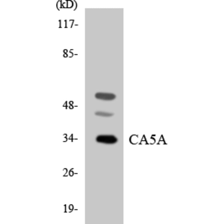 Western Blot - Anti-CA5A Antibody (R12-2557) - Antibodies.com