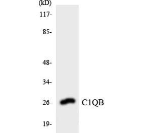 Western Blot - Anti-C1QB Antibody (R12-2552) - Antibodies.com