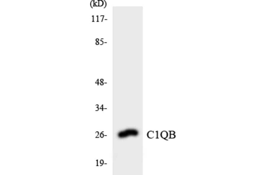 Western Blot - Anti-C1QB Antibody (R12-2552) - Antibodies.com