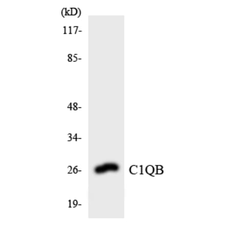 Western Blot - Anti-C1QB Antibody (R12-2552) - Antibodies.com