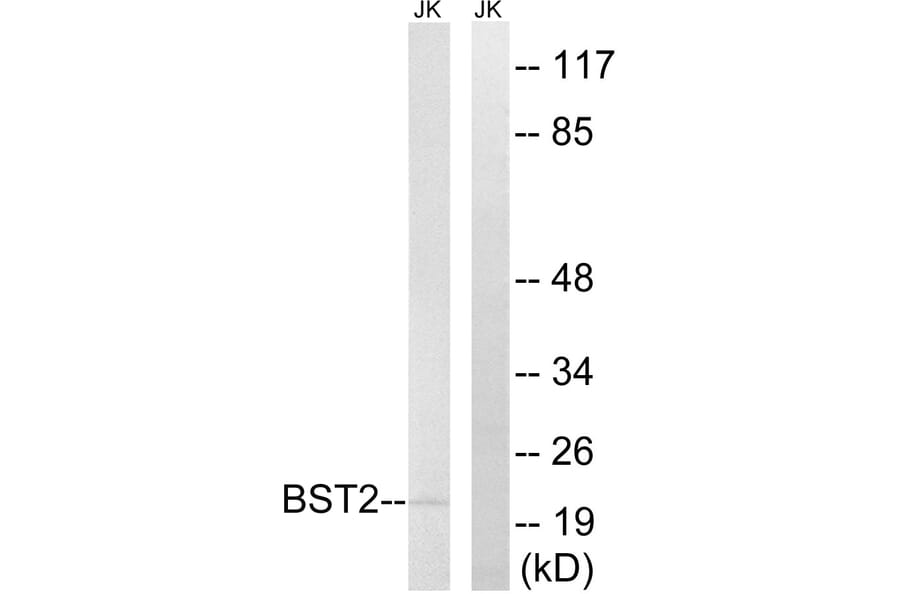 Western Blot - Anti-BST2 Antibody (C14755) - Antibodies.com