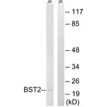 Western Blot - Anti-BST2 Antibody (C14755) - Antibodies.com