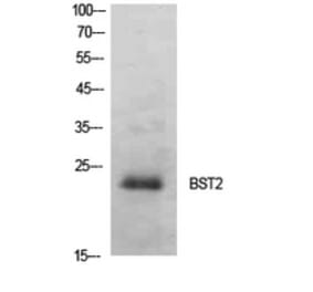 Western Blot - Anti-BST2 Antibody (C30440) - Antibodies.com