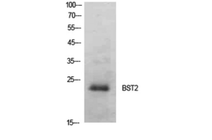 Western Blot - Anti-BST2 Antibody (C30440) - Antibodies.com