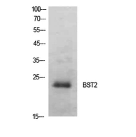 Western Blot - Anti-BST2 Antibody (C30440) - Antibodies.com