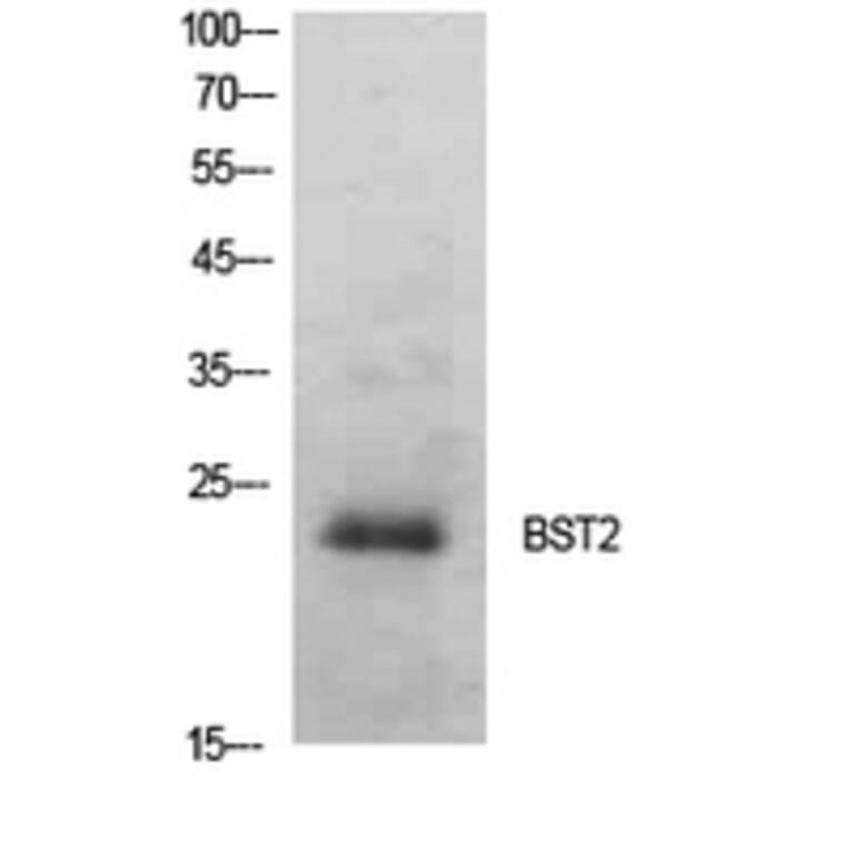 Western Blot - Anti-BST2 Antibody (C30440) - Antibodies.com