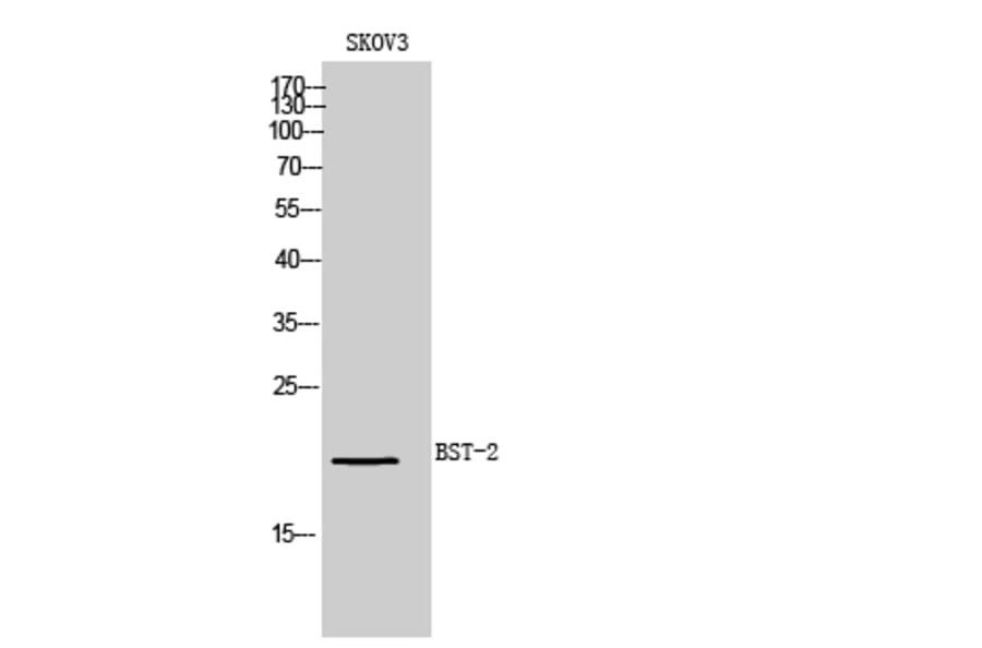Western Blot - Anti-BST2 Antibody (C30440) - Antibodies.com