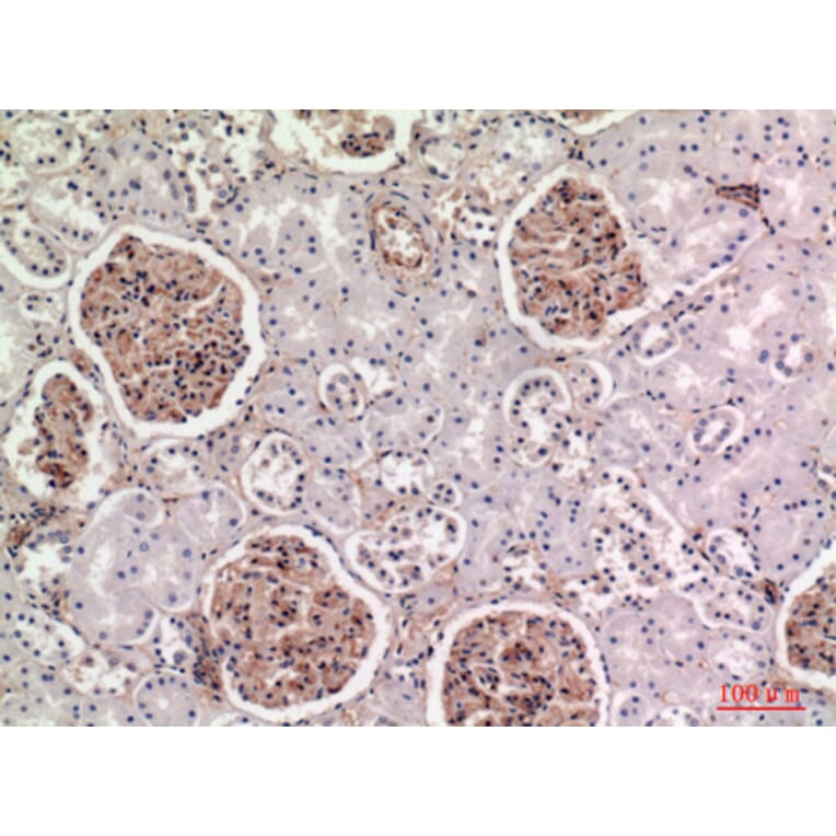 Immunohistochemistry - Anti-BST2 Antibody (C30440) - Antibodies.com