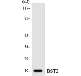 Western Blot - Anti-BST2 Antibody (R12-2549) - Antibodies.com