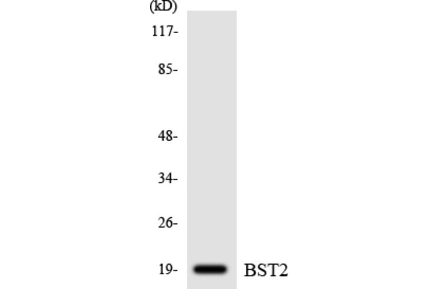 Western Blot - Anti-BST2 Antibody (R12-2549) - Antibodies.com