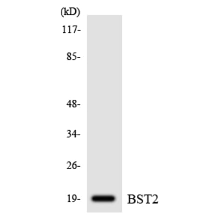 Western Blot - Anti-BST2 Antibody (R12-2549) - Antibodies.com