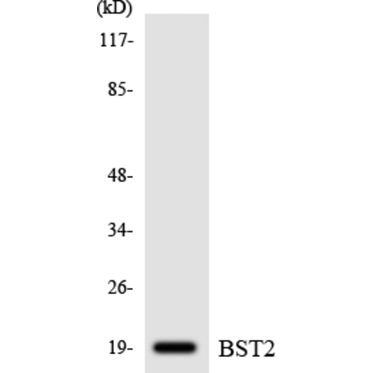 Western Blot - Anti-BST2 Antibody (R12-2549) - Antibodies.com
