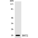 Western Blot - Anti-BST2 Antibody (R12-2549) - Antibodies.com