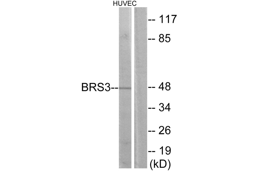 Western Blot - Anti-BRS3 Antibody (G217) - Antibodies.com
