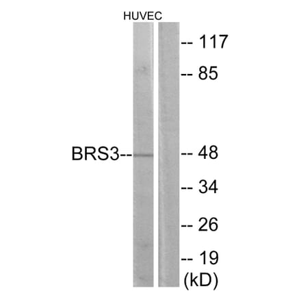 Western Blot - Anti-BRS3 Antibody (G217) - Antibodies.com