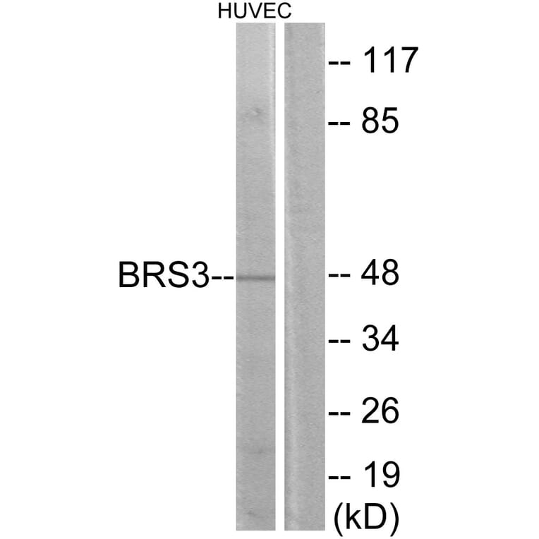Western Blot - Anti-BRS3 Antibody (G217) - Antibodies.com