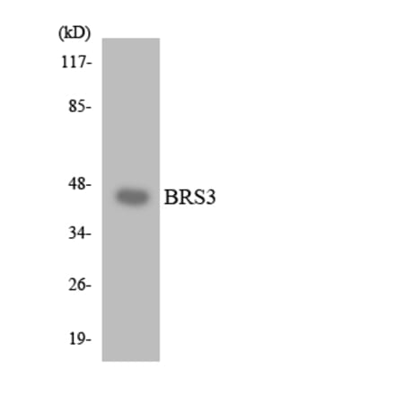 Western Blot - Anti-BRS3 Antibody (R12-2547) - Antibodies.com