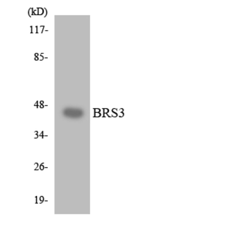 Western Blot - Anti-BRS3 Antibody (R12-2547) - Antibodies.com
