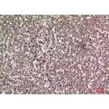 Immunohistochemistry - Anti-BAG3 Antibody (C30035) - Antibodies.com