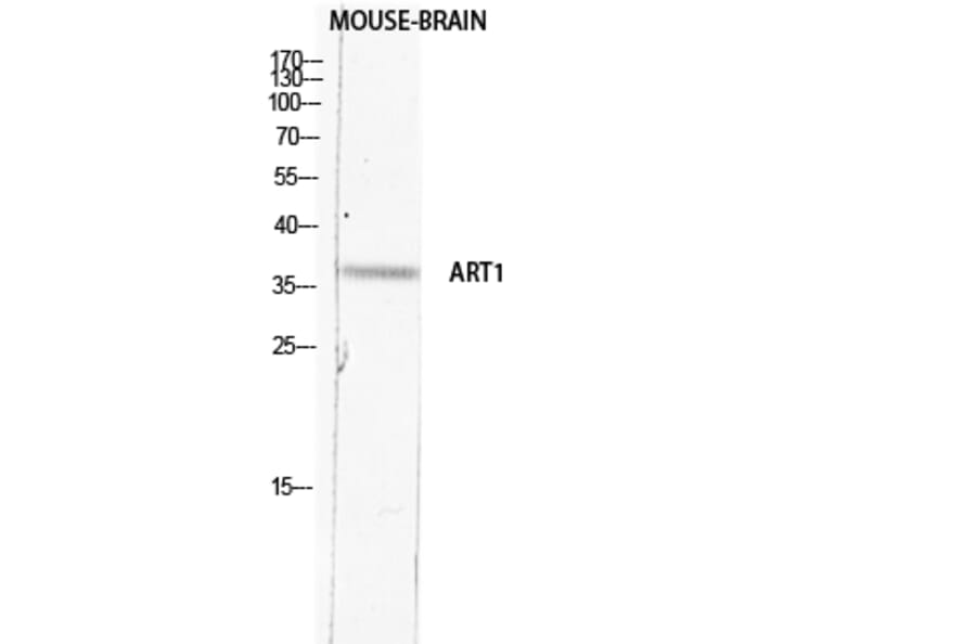 Western Blot - Anti-ART1 Antibody (C30542) - Antibodies.com