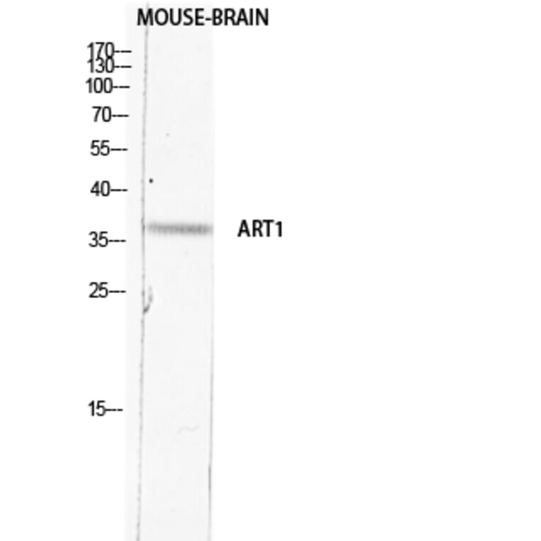 Western Blot - Anti-ART1 Antibody (C30542) - Antibodies.com