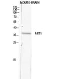 Western Blot - Anti-ART1 Antibody (C30542) - Antibodies.com