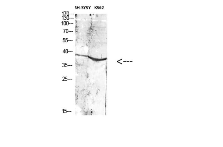 Western Blot - Anti-ART1 Antibody (C30542) - Antibodies.com