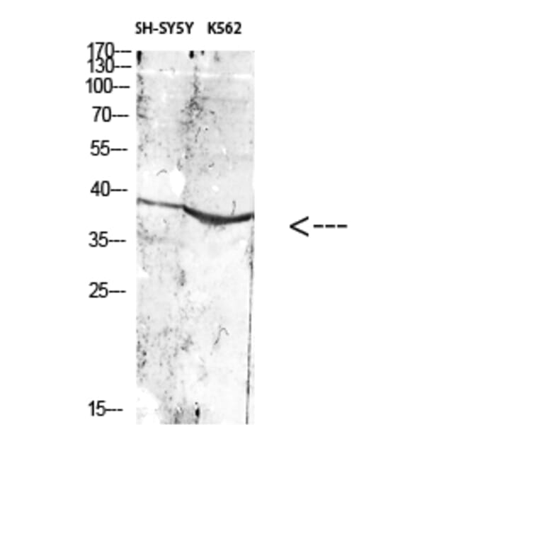 Western Blot - Anti-ART1 Antibody (C30542) - Antibodies.com