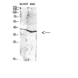 Western Blot - Anti-ART1 Antibody (C30542) - Antibodies.com