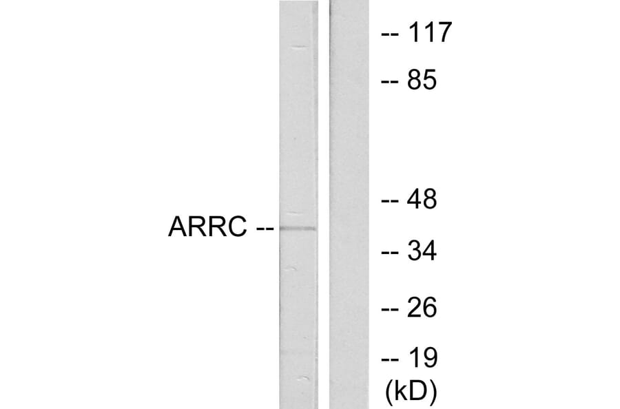 Western Blot - Anti-ARRC Antibody (C12058) - Antibodies.com