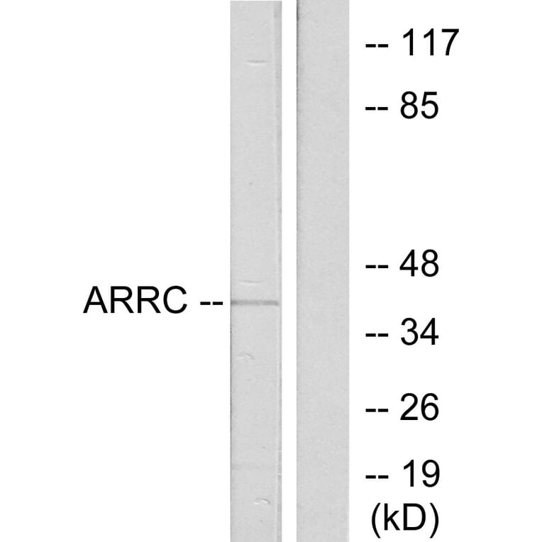 Western Blot - Anti-ARRC Antibody (C12058) - Antibodies.com