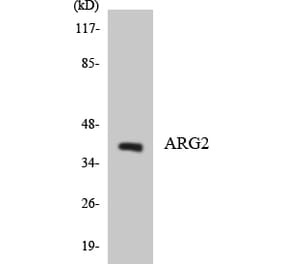 Western Blot - Anti-ARG2 Antibody (R12-2502) - Antibodies.com