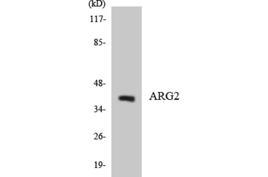 Western Blot - Anti-ARG2 Antibody (R12-2502) - Antibodies.com