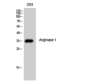 Western Blot - Anti-ARG1 Antibody (C14559) - Antibodies.com