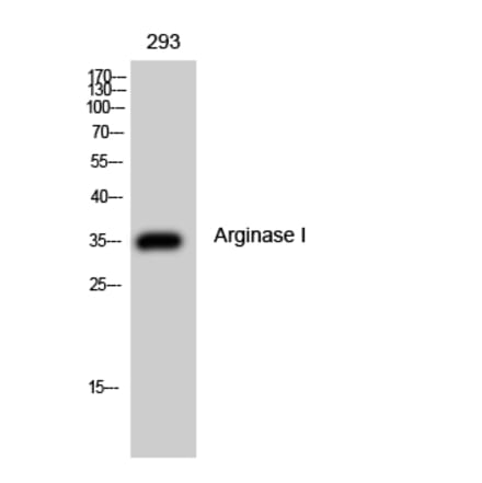 Western Blot - Anti-ARG1 Antibody (C14559) - Antibodies.com