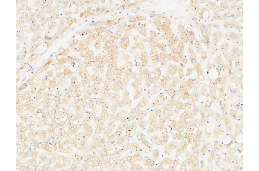 Immunohistochemistry - Anti-ARG1 Antibody (C14559) - Antibodies.com
