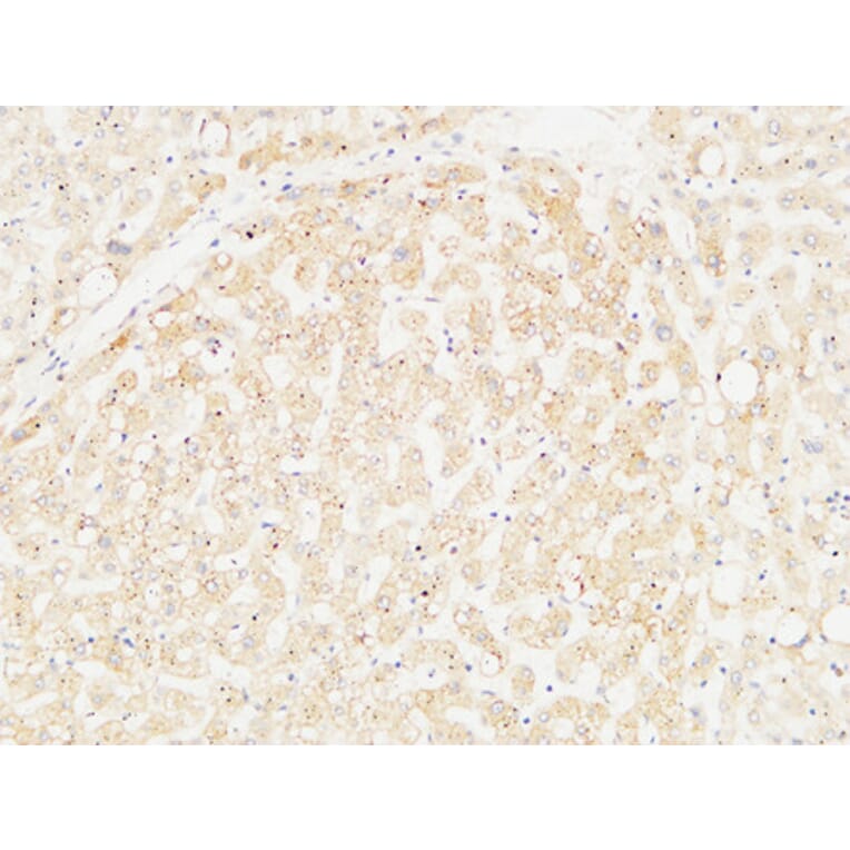 Immunohistochemistry - Anti-ARG1 Antibody (C14559) - Antibodies.com