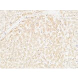 Immunohistochemistry - Anti-ARG1 Antibody (C14559) - Antibodies.com