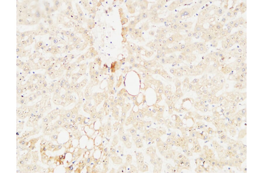 Immunohistochemistry - Anti-ARG1 Antibody (C14559) - Antibodies.com