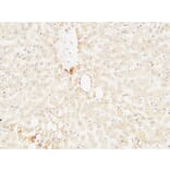 Immunohistochemistry - Anti-ARG1 Antibody (C14559) - Antibodies.com