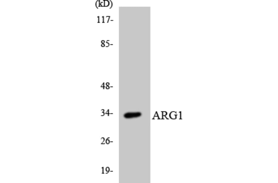 Western Blot - Anti-ARG1 Antibody (R12-2501) - Antibodies.com